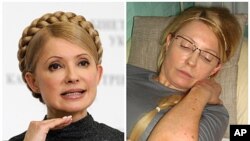 Bà Yulia Tymoshenko (hình chụp ngày 29/12/2009) và hình ngày 25/4/2012, cho thấy bà Yulia với những vết bầm tím trên cơ thể trong nhà tù ở Kharkiv